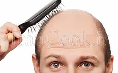 راههای جلوگیری از ریزش مو در آقایان